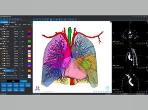 Servicios de reconstrucción 3D médica e impresión 3D